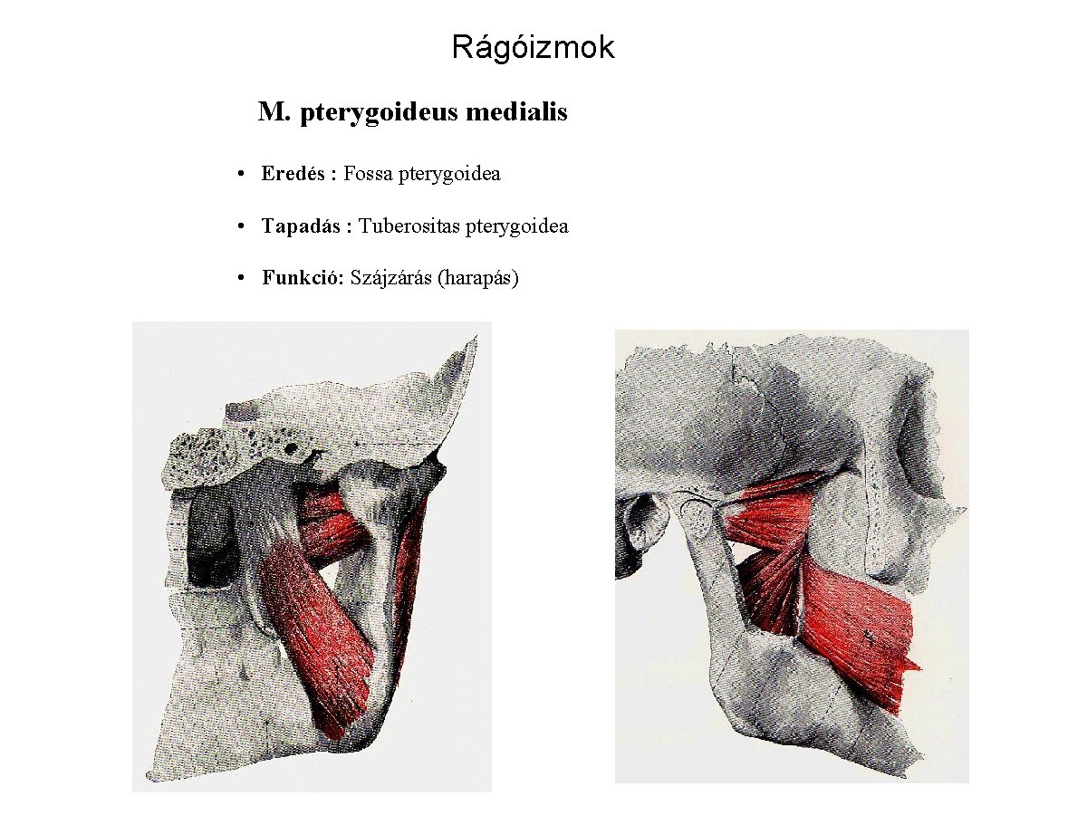 Rágóizmok M. pterygoideus medialis • Eredés : Fossa pterygoidea • Tapadás : Tuberositas pterygoidea