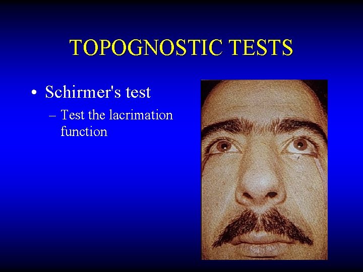 TOPOGNOSTIC TESTS • Schirmer's test – Test the lacrimation function 