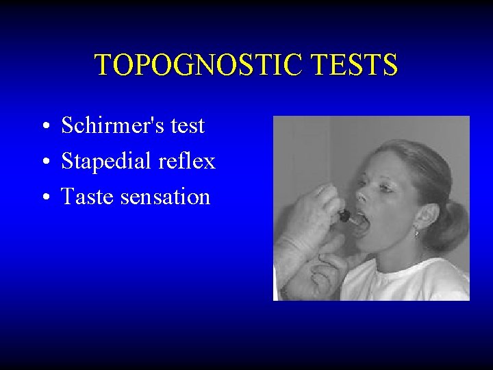 TOPOGNOSTIC TESTS • Schirmer's test • Stapedial reflex • Taste sensation 