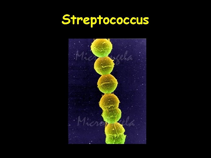 Streptococcus 