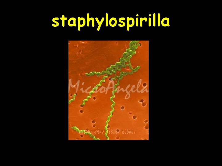 staphylospirilla 
