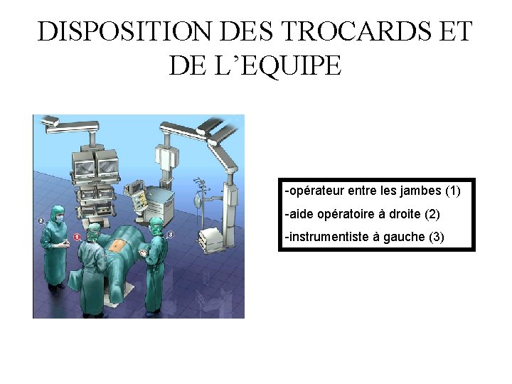 DISPOSITION DES TROCARDS ET DE L’EQUIPE -opérateur entre les jambes (1) -aide opératoire à