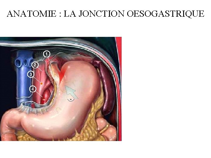 ANATOMIE : LA JONCTION OESOGASTRIQUE 