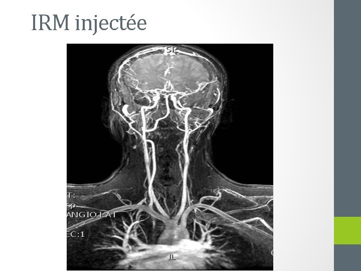 IRM injectée 