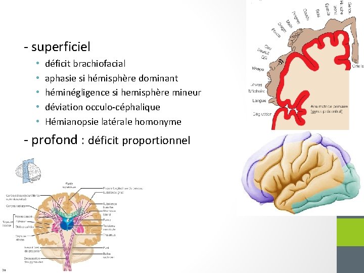 - superficiel • • • déficit brachiofacial aphasie si hémisphère dominant héminégligence si hemisphère