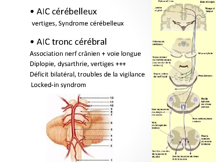  • AIC cérébelleux -vertiges, Syndrome cérébelleux • AIC tronc cérébral Association nerf crânien