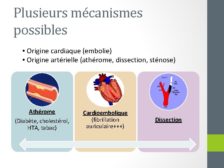 Plusieurs mécanismes possibles • Origine cardiaque (embolie) • Origine artérielle (athérome, dissection, sténose) Athérome
