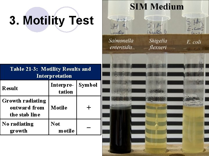 3. Motility Test Table 21 -3: Motility Results and Interpretation Result Interpre- Symbol tation
