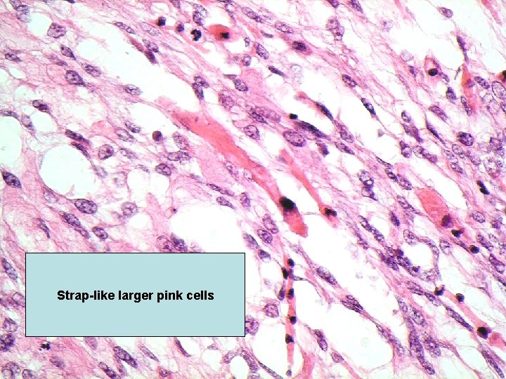 Strap-like larger pink cells 