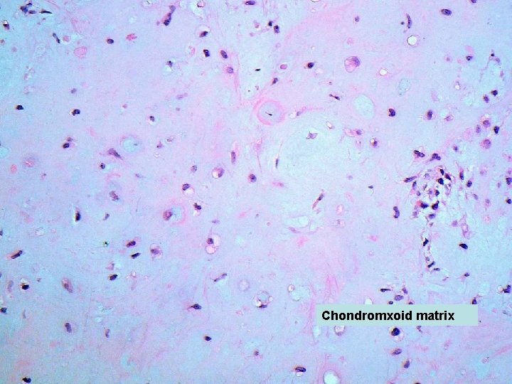 Chondromxoid matrix 