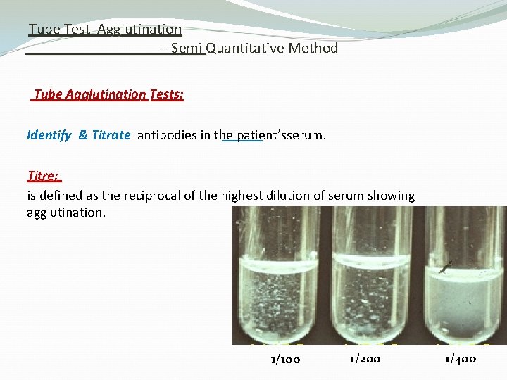 Tube Test Agglutination -- Semi Quantitative Method Tube Agglutination Tests: Identify & Titrate antibodies