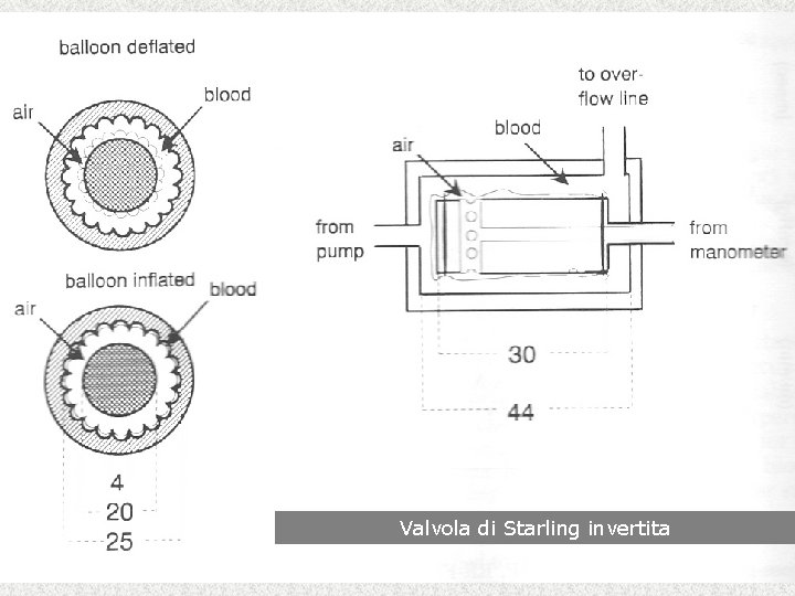 Valvola di Starling invertita 