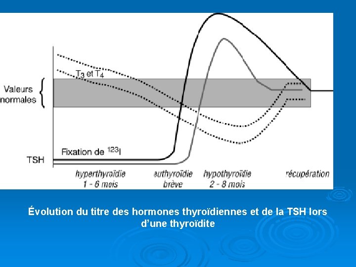 Évolution du titre des hormones thyroïdiennes et de la TSH lors d’une thyroïdite 