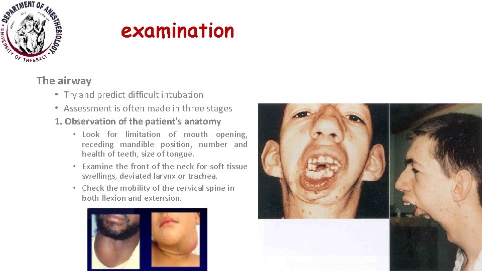 examination The airway • Try and predict difficult intubation • Assessment is often made