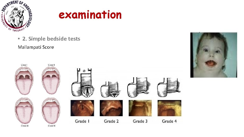 examination • 2. Simple bedside tests Mallampati Score 