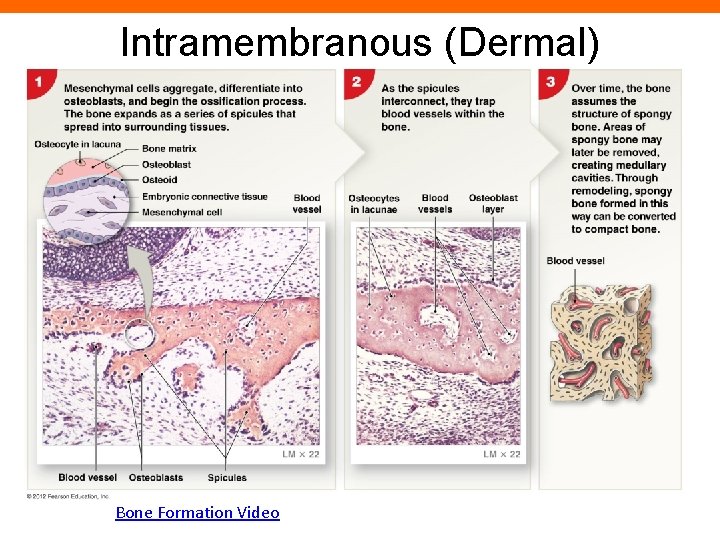 Intramembranous (Dermal) Ossification Bone Formation Video 