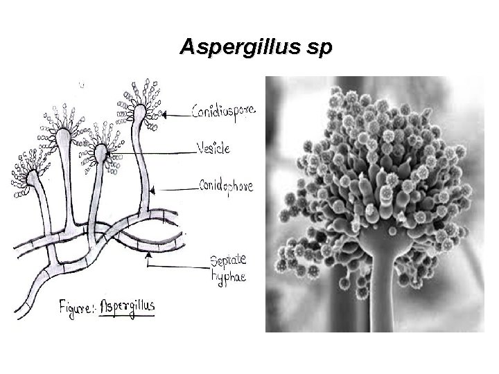 Aspergillus sp 