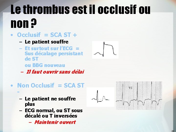 Le thrombus est il occlusif ou non ? • Occlusif = SCA ST +