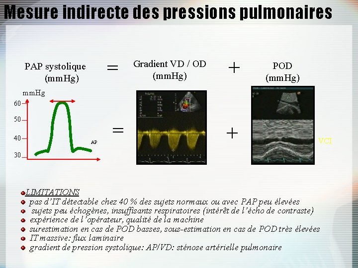 Mesure indirecte des pressions pulmonaires = PAP systolique (mm. Hg) Gradient VD / OD