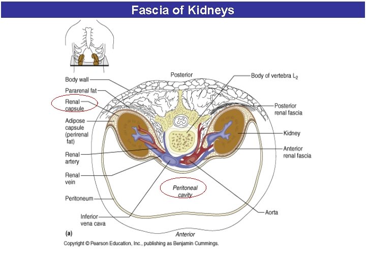 Fascia of Kidneys 