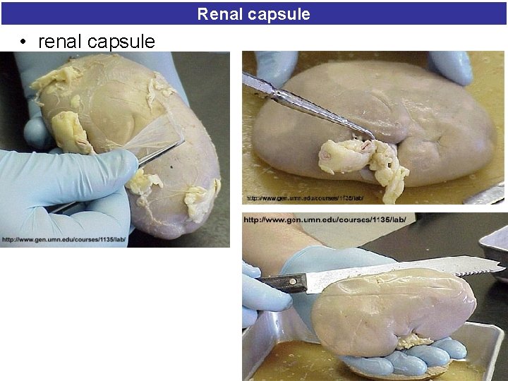 Renal capsule • renal capsule 