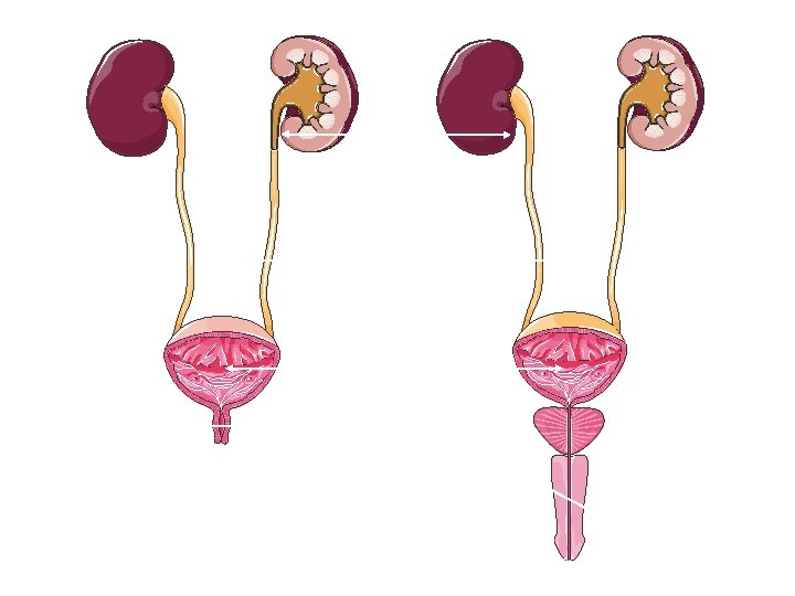 Prostate Male 