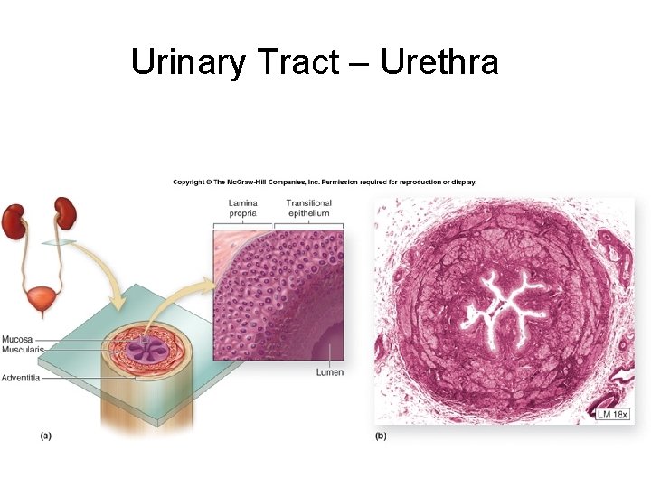 Urinary Tract – Urethra 