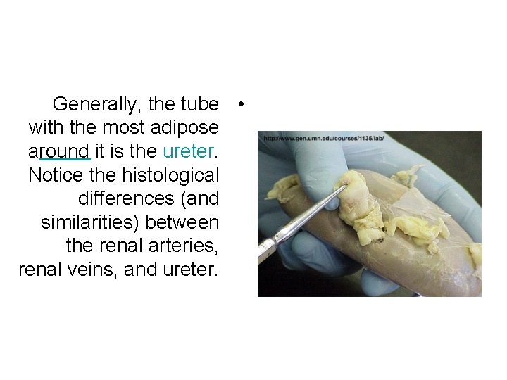 Generally, the tube • with the most adipose around it is the ureter. Notice