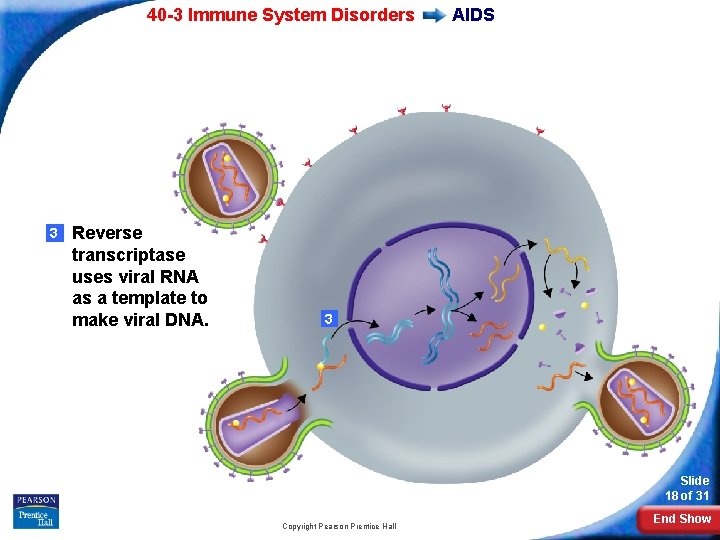 40 -3 Immune System Disorders 3 Reverse transcriptase uses viral RNA as a template