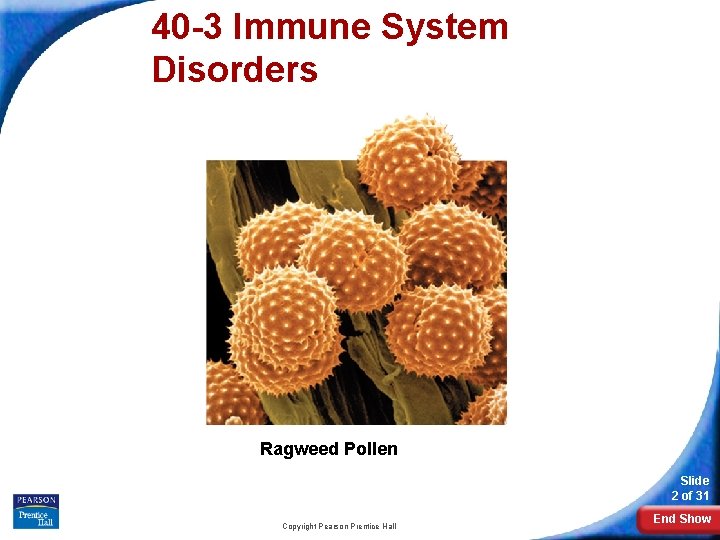 40 -3 Immune System Disorders Ragweed Pollen Slide 2 of 31 Copyright Pearson Prentice