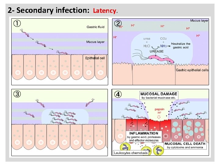 a 2 - Secondary infection: Latency. 