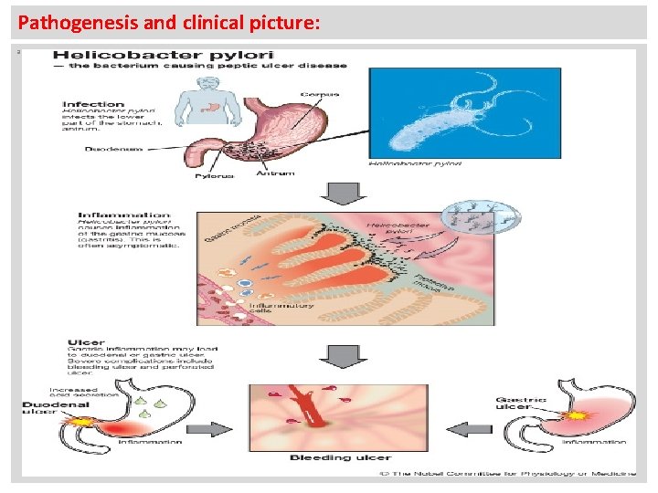 Pathogenesis and clinical picture: a 