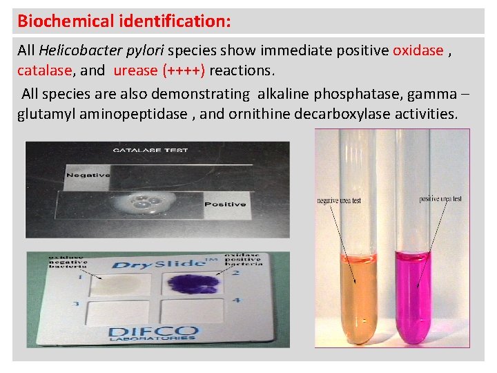 Biochemical identification: All Helicobacter pylori species show immediate positive oxidase , catalase, and urease