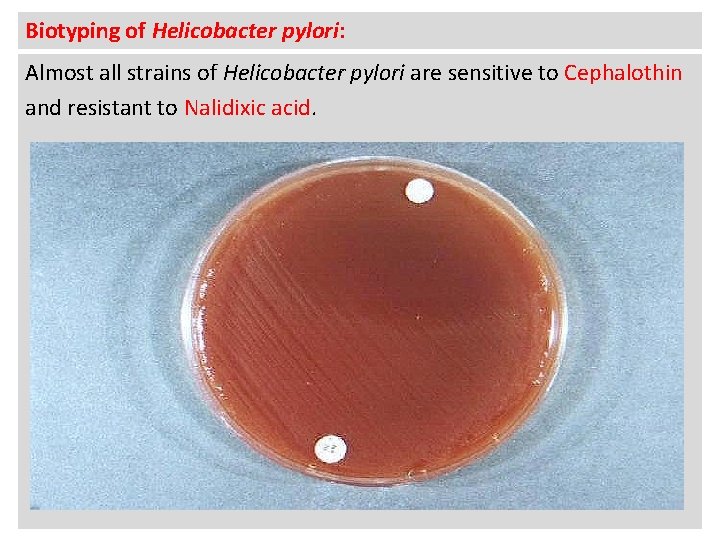 Biotyping of Helicobacter pylori: Almost all strains of Helicobacter pylori are sensitive to Cephalothin