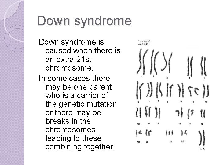 Down syndrome is caused when there is an extra 21 st chromosome. In some