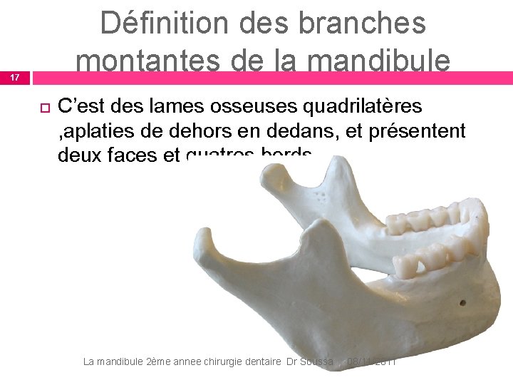 Définition des branches montantes de la mandibule 17 C’est des lames osseuses quadrilatères , Définition des branches montantes de la mandibule 17 C’est des lames osseuses quadrilatères ,