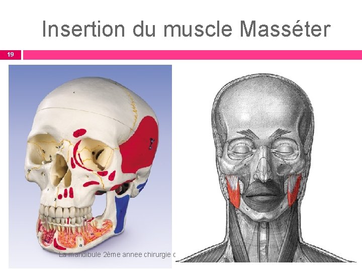 Insertion du muscle Masséter 19 La mandibule 2ème annee chirurgie dentaire Dr Soussa 08/11/2011 Insertion du muscle Masséter 19 La mandibule 2ème annee chirurgie dentaire Dr Soussa 08/11/2011