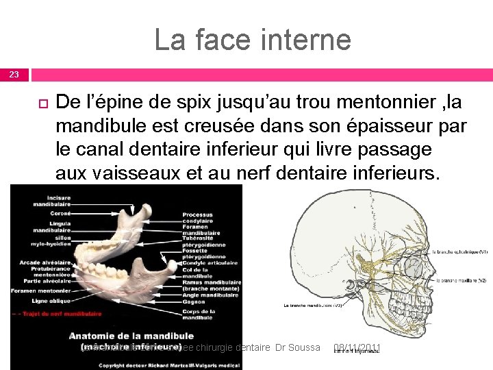 La face interne 23 De l’épine de spix jusqu’au trou mentonnier , la mandibule La face interne 23 De l’épine de spix jusqu’au trou mentonnier , la mandibule