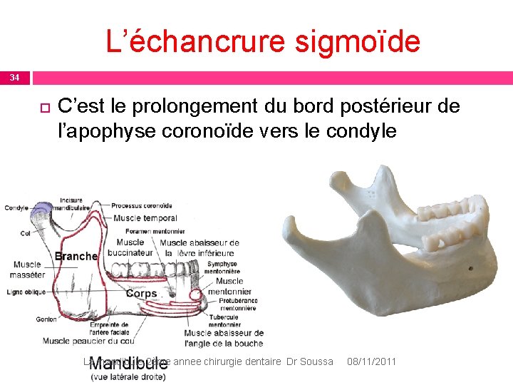 L’échancrure sigmoïde 34 C’est le prolongement du bord postérieur de l’apophyse coronoïde vers le L’échancrure sigmoïde 34 C’est le prolongement du bord postérieur de l’apophyse coronoïde vers le
