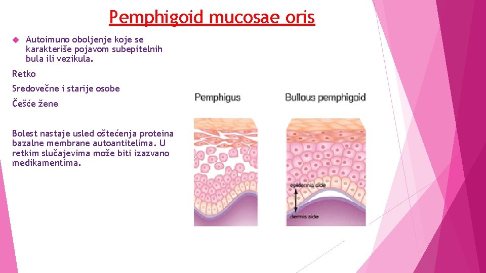 Pemphigoid mucosae oris Autoimuno oboljenje koje se karakteriše pojavom subepitelnih bula ili vezikula. Retko