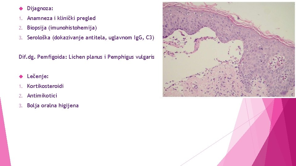  Dijagnoza: 1. Anamneza i klinički pregled 2. Biopsija (imunohistohemija) 3. Serološka (dokazivanje antitela,