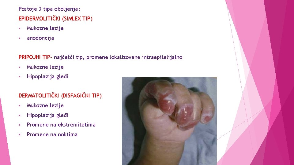 Postoje 3 tipa oboljenja: EPIDERMOLITIČKI (SIMLEX TIP) • Mukozne lezije • anodoncija PRIPOJNI TIP-