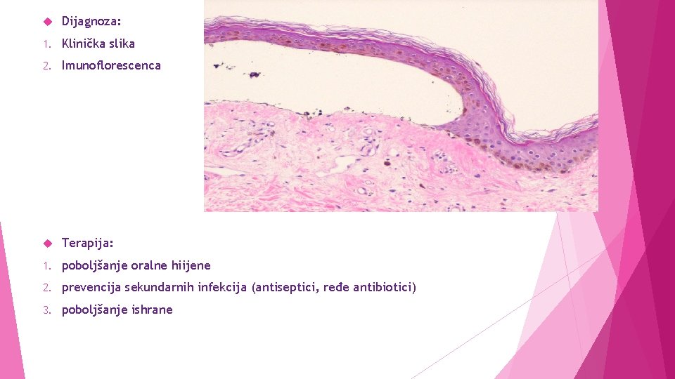  Dijagnoza: 1. Klinička slika 2. Imunoflorescenca Terapija: 1. poboljšanje oralne hiijene 2. prevencija