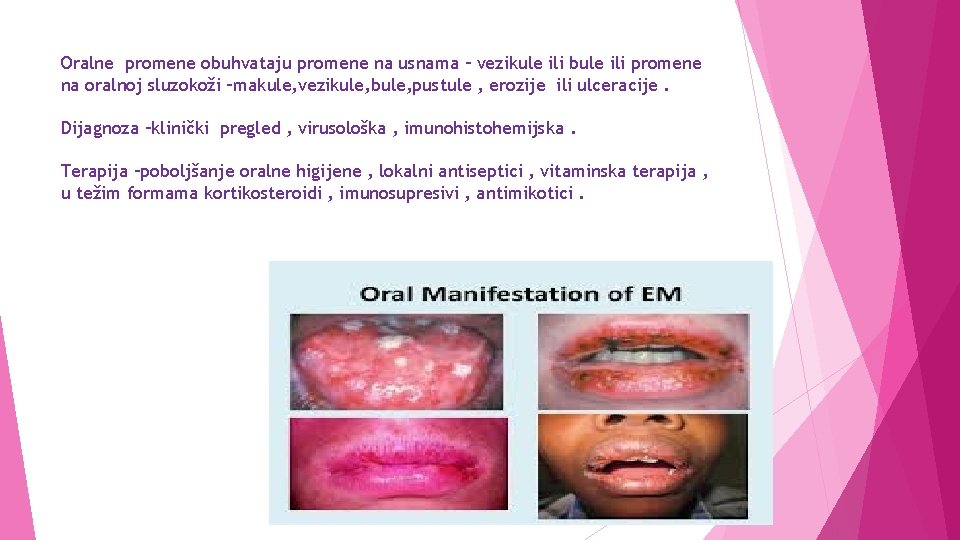 Oralne promene obuhvataju promene na usnama – vezikule ili bule ili promene na oralnoj