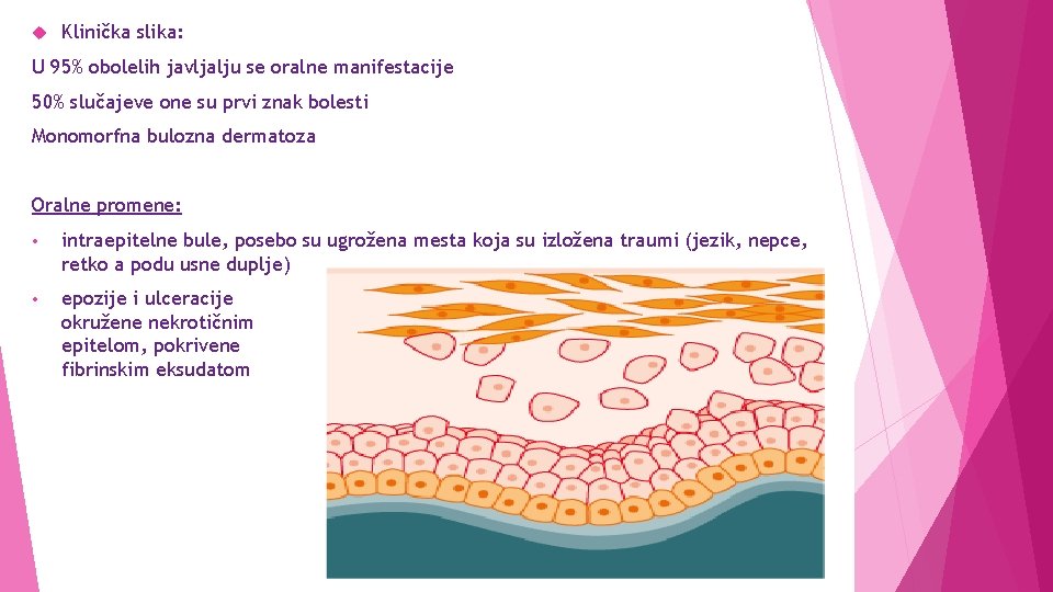  Klinička slika: U 95% obolelih javljalju se oralne manifestacije 50% slučajeve one su