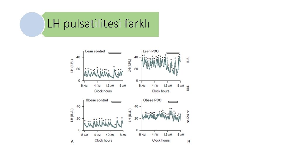 LH pulsatilitesi farklı 