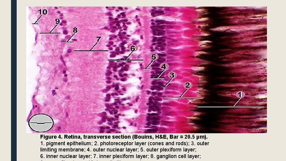 Figure 4. Retina, transverse section (Bouins, H&E, Bar = 20. 5 µm). 1. pigment