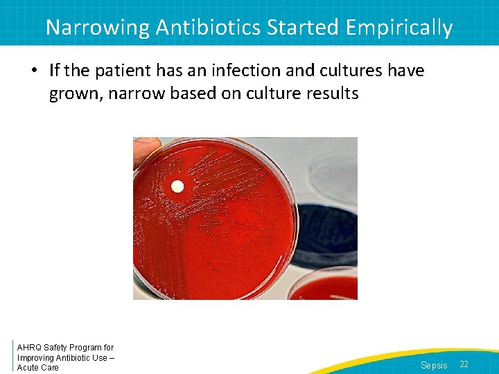 Narrowing Antibiotics Started Empirically • If the patient has an infection and cultures have