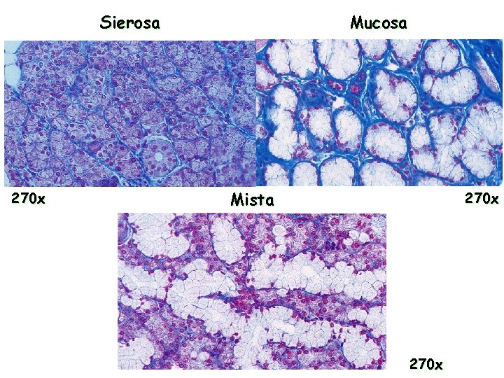 Sierosa 270 x Mucosa Mista 270 x 