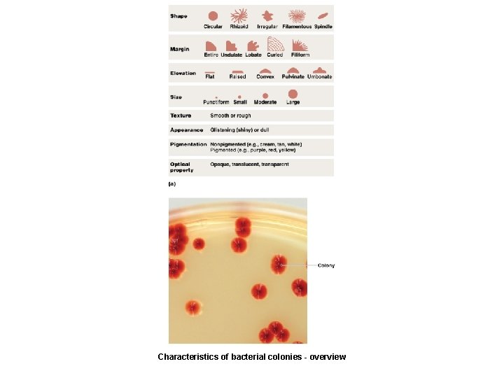 Characteristics of bacterial colonies - overview 